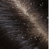 Hair Care Gift Set For Irritated Scalp